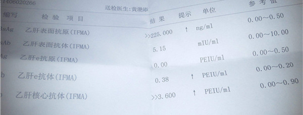 教你看化验单3——乙肝两对半化验单