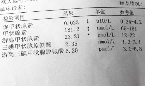 教你看化验单4—看懂甲状腺功能5项检查化验单