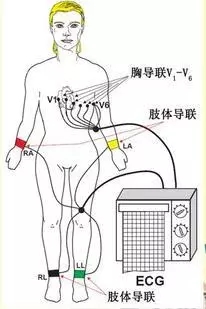 医学生做了个心电图,把所有人逗乐了